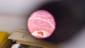 Filming the End of Life