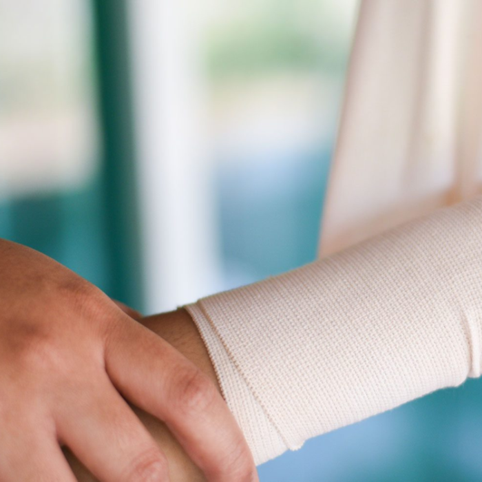 Person with a cast on their forearm and wrist