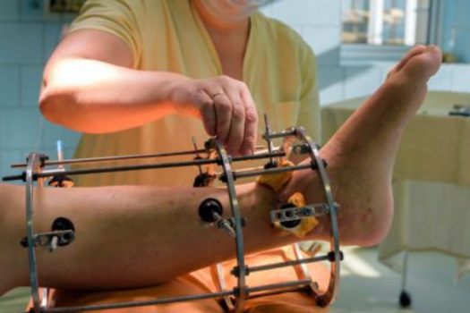 Limb Reconstruction Fellowship