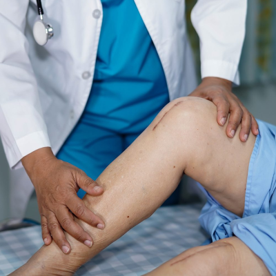 A doctor examining a patient's knee which has just undergone a replacement operation