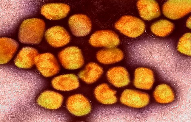 Colorized transmission electron micrograph of monkeypox virus particles (gold) cultivated and purified from cell culture. Image captured at the NIAID Integrated Research Facility (IRF) in Fort Detrick, Maryland. Credit: NIAID