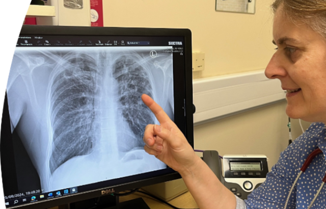 A woman looking at an x-ray of lungs