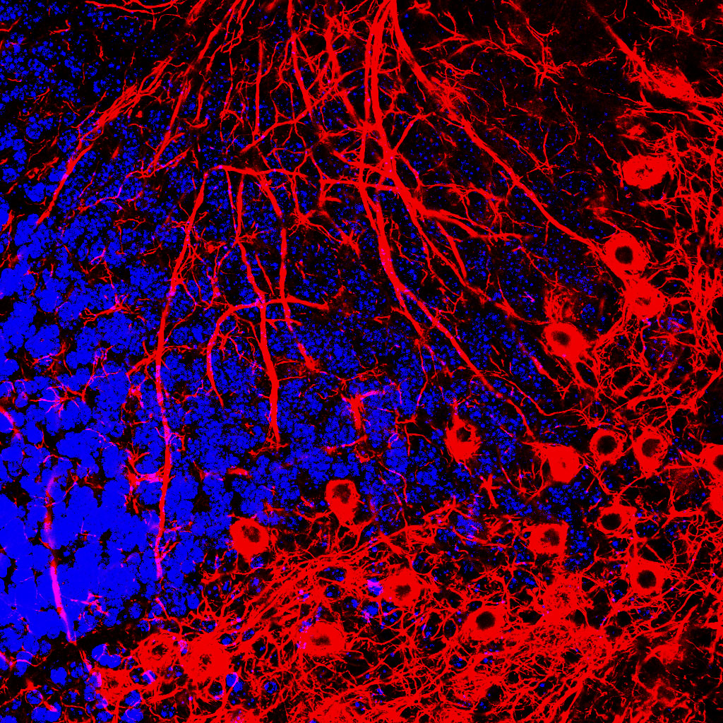 Stained and illuminated neurons