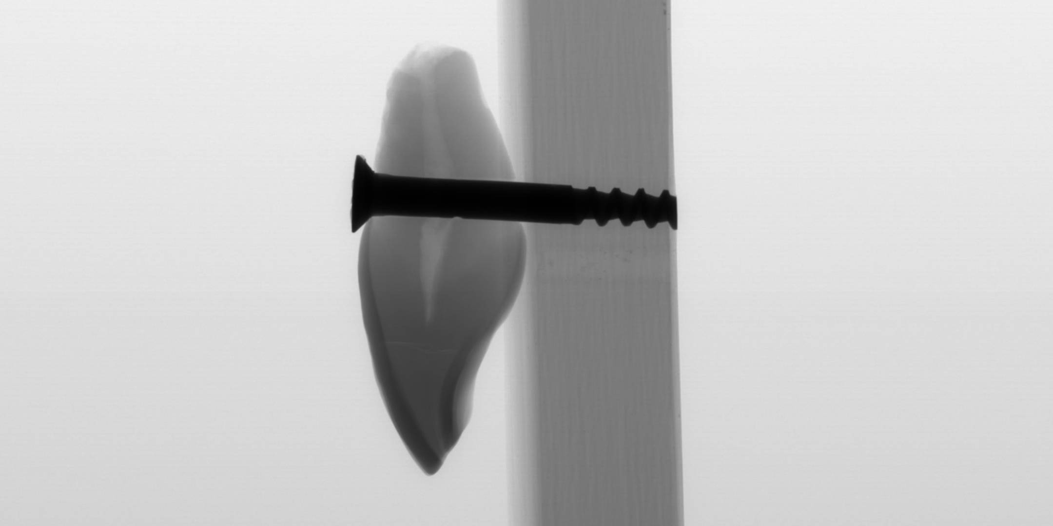 scan of a tooth with a screw through it