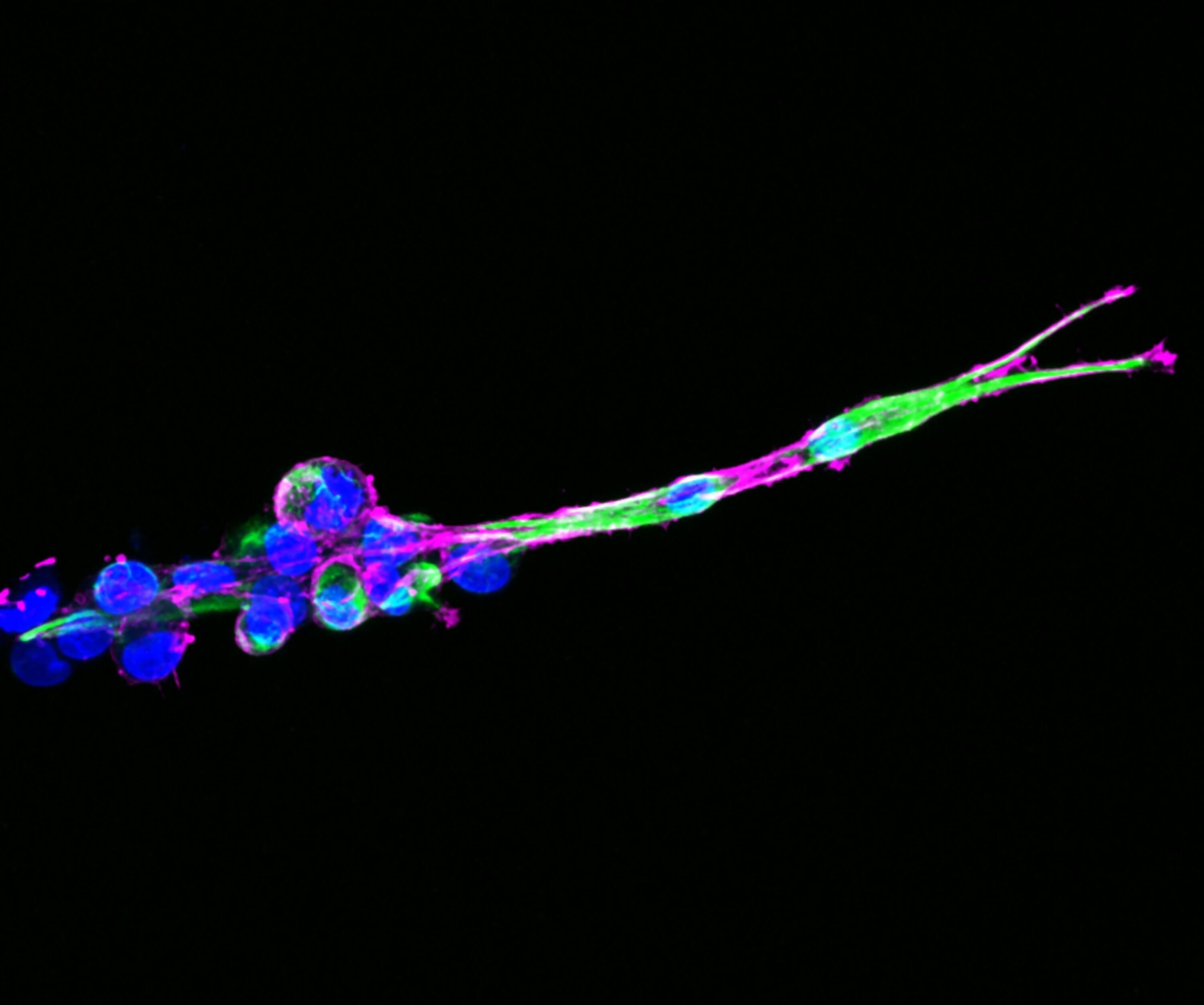 Case Study &ndash; Chellaram Foundation 