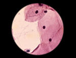 A cytologic smear under the microscope