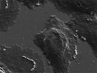 Pneumococci bacteria sticking to airway cells