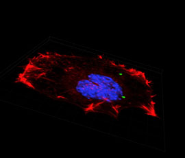 A cancer cell which has taken up microparticles developed by BioMoti