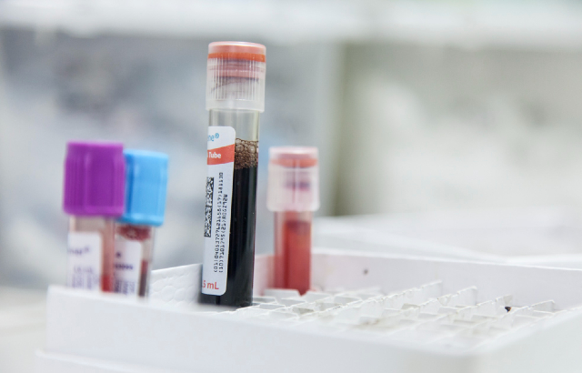 Vials containing blood. Credit:Centre for Trauma Sciences.