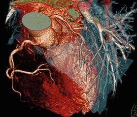 Looking through the heart