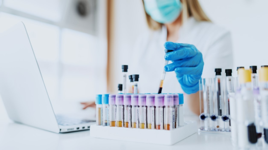 Queen Mary University spinout Procyon Diagnostics to provide early cancer tests 