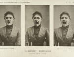 A photo by Albert Londe of a ‘hysterical’ woman taken around 1890. Wellcome Library