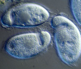 The single-celled Plagiopyla © B.J. Finlay