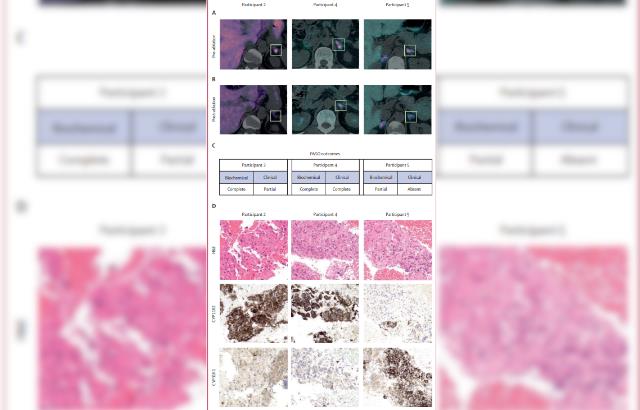 Molecular Imaging of the Adrenal Glands in 3 Patients.