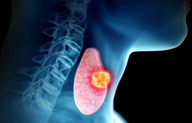 Thyroid Illustration